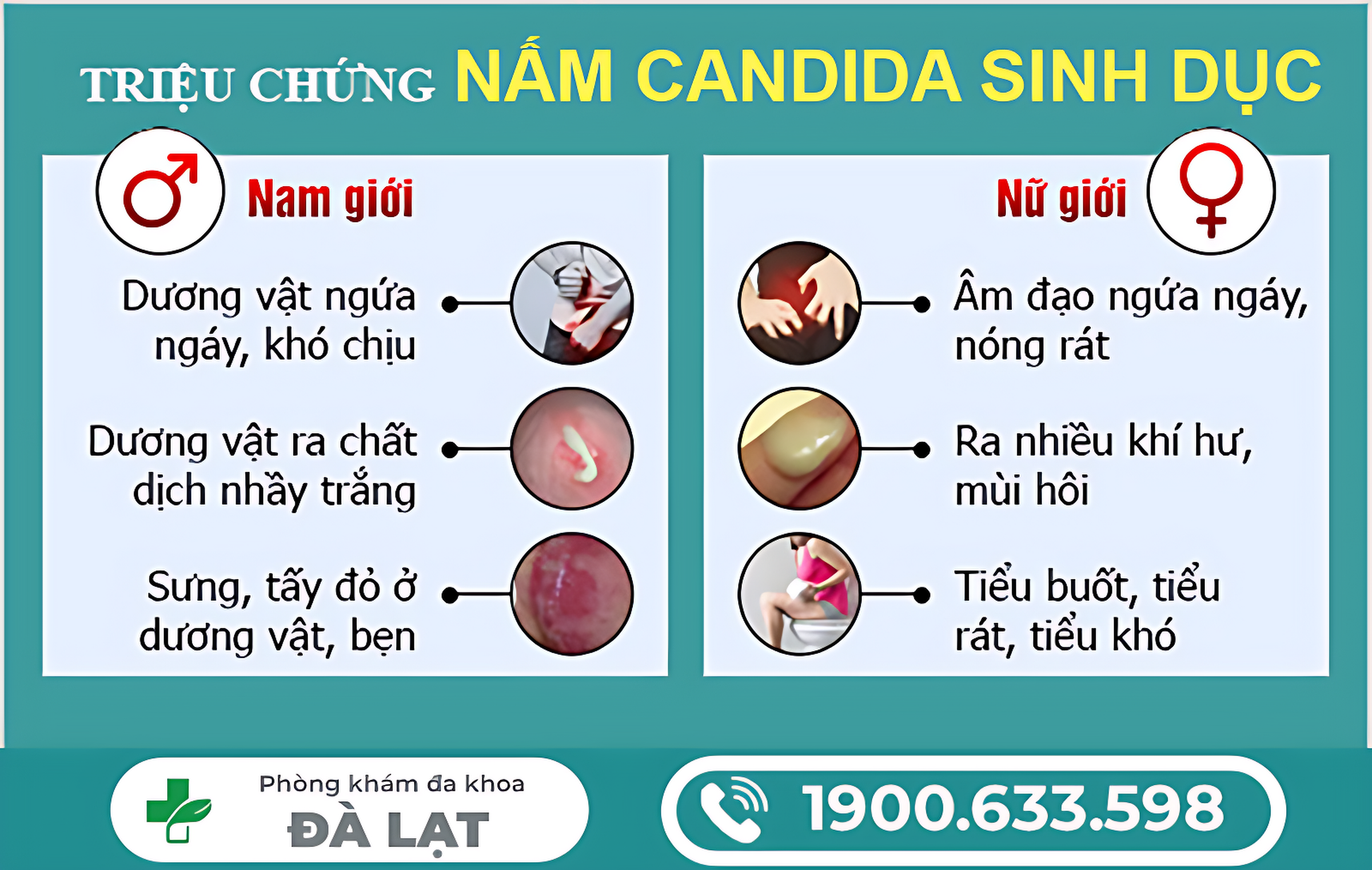 Hình ảnh minh họa